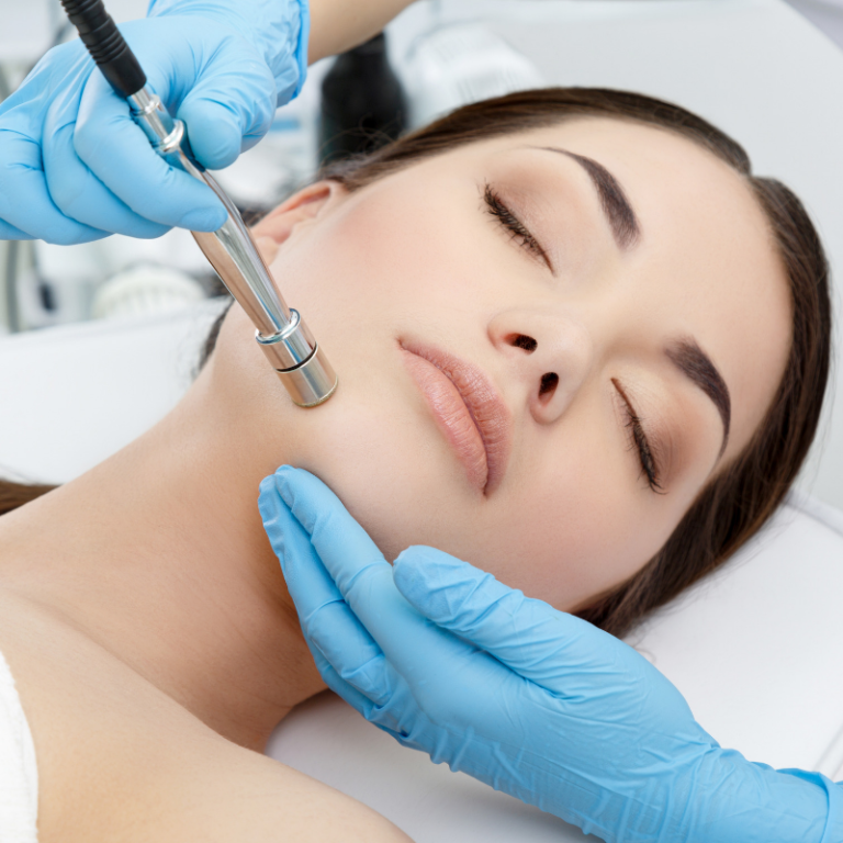 Microdermabrasion Aislinn Medical Spa